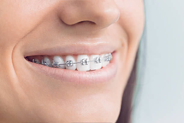 Best Dental Inlays and Onlays  in Gig Harbor, WA